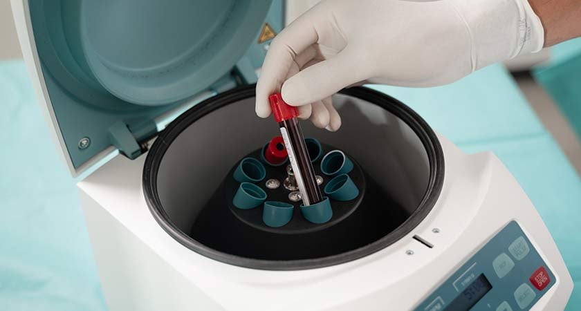 PRP-Eigenblut PRP-Eigenblut